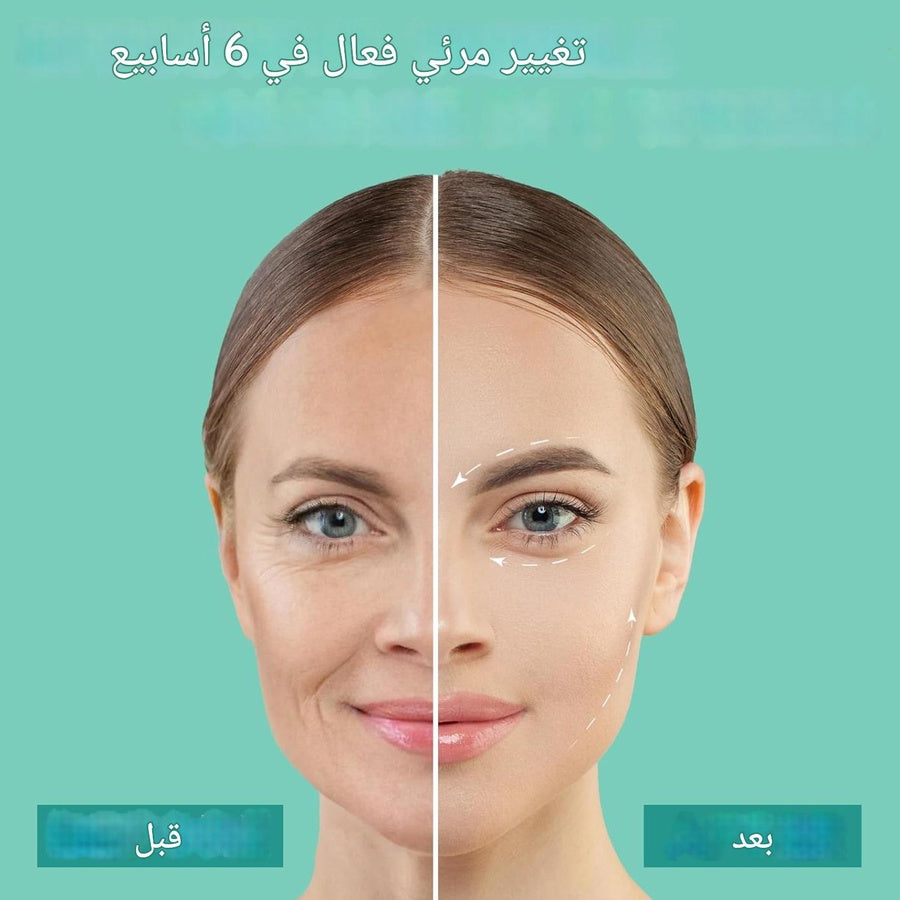 جهاز العناية بالبشرة وشد الوجه بتقنية HIFU