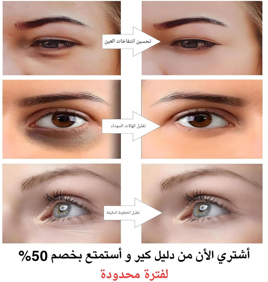 نظارة علاج بالضوء الاحمر لتجاعيد العين